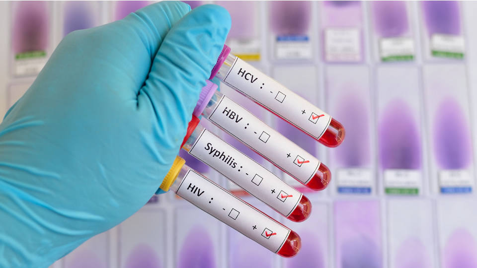 Labordiagnostik - Lues, Chlamydien, Gonorrhoe und HIV